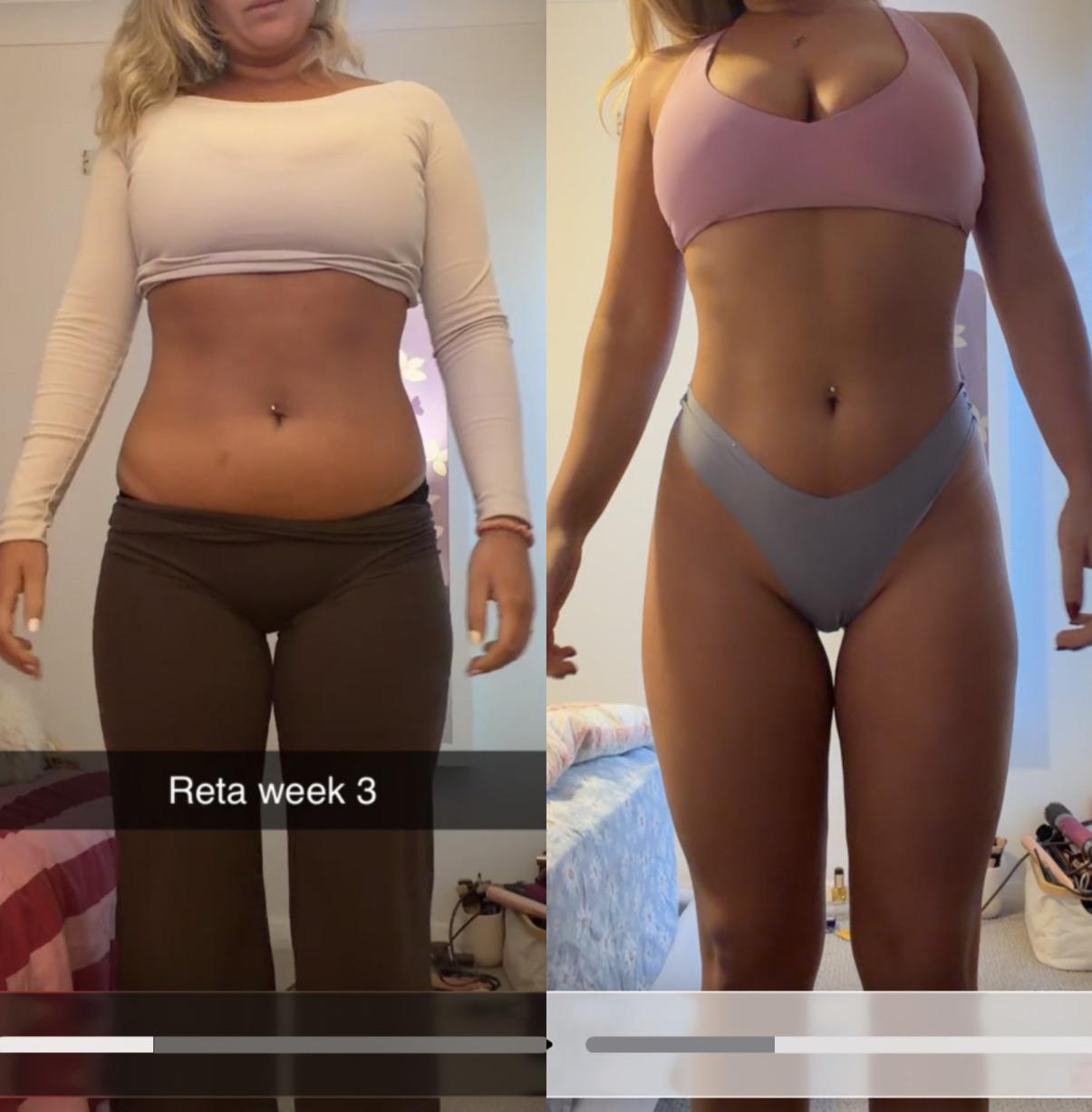 Researcher-submitted before/after reference photo, female subject